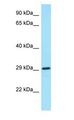 CSF2RA / CD116 Antibody - CSF2RA / CD116 antibody Western Blot of Fetal Heart.  This image was taken for the unconjugated form of this product. Other forms have not been tested.