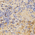 CSF2RA / CD116 Antibody - Immunohistochemistry of paraffin-embedded mouse liver fibrosis tissue using Map2 antibody at dilution of 1:200 (x400 lens)