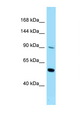 CSF2RB / CD131 Antibody - CSF2RB / CD131 antibody Western blot of Fetal Heart lysate. Antibody concentration 1 ug/ml.  This image was taken for the unconjugated form of this product. Other forms have not been tested.