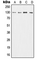 CSF2RB / CD131 Antibody - Western blot analysis of CD131 expression in HL60 (A); TF1 (B); SP2/0 (C); H9C2 (D) whole cell lysates.