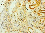 CSNK1A1L Antibody - Immunohistochemistry of paraffin-embedded human kidney using antibody at 1:100 dilution.