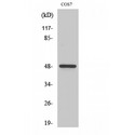 CSNK1G1 / CKI-Gamma 1 Antibody - Western blot of Casein Kinase Igamma1 antibody