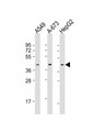 CSNK2A3 / CSNK2A1P Antibody - All lanes: Anti-CSNK2A3 Antibody (C-Term) at 1:1000 dilution. Lane 1: A549 whole cell lysate. Lane 2: A-673 whole cell lysate. Lane 3: HepG2 whole cell lysate Lysates/proteins at 20 ug per lane. Secondary Goat Anti-Rabbit IgG, (H+L), Peroxidase conjugated at 1:10000 dilution. Predicted band size: 45 kDa. Blocking/Dilution buffer: 5% NFDM/TBST.