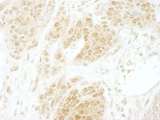 CSNK2B / Phosvitin Antibody - Detection of Mouse CKII-beta by Immunohistochemistry. Sample: FFPE section of mouse teratoma. Antibody: Affinity purified rabbit anti-CKII beta used at a dilution of 1:250. Epitope Retrieval Buffer-High pH (IHC-101J) was substituted for Epitope Retrieval Buffer-Reduced pH.