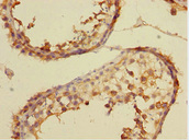 CSRNP2 / FAM130A1 Antibody - Immunohistochemistry of paraffin-embedded human testis tissue at dilution 1:100