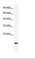 CSRP3 Antibody - Jurkat Cell Lysate.  This image was taken for the unconjugated form of this product. Other forms have not been tested.