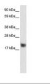 CSRP3 Antibody - Fetal Muscle Lysate.  This image was taken for the unconjugated form of this product. Other forms have not been tested.