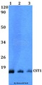CST1 / Cystatin SN Antibody - Western blot of CST1 antibody at 1:500 dilution. Lane 1: HEK293T whole cell lysate. Lane 2: sp2/0 whole cell lysate. Lane 3: PC12 whole cell lysate.