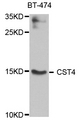 CST4 / Cystatin S Antibody - Western blot analysis of extract of various cells.