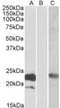 CST8 / CRES Antibody - HEK293 lysate (10ug protein in RIPA buffer) overexpressing Human CST8 (RC210130) with C-terminal MYC tag probed with (0.3ug/ml) in Lane A and probed with anti-MYC Tag (1/1000) in lane C. Mock-transfected HEK294 probed with (1mg/ml) in Lane