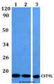 CST9L / Cystatin 9-Like Antibody - Western blot of CST9L antibody at 1:500 dilution. Lane 1: HEK293T whole cell lysate. Lane 2: Raw264.7 whole cell lysate. Lane 3: PC12 whole cell lysate.