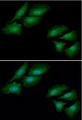 CSTF1 Antibody - ICC/IF analysis of CSTF1 in HeLa cells line, stained with DAPI (Blue) for nucleus staining and monoclonal anti-human CSTF1 antibody (1:100) with goat anti-mouse IgG-Alexa fluor 488 conjugate (Green).