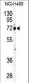 CSTF2 / CstF-64 Antibody - Western blot of anti-CSTF2 Antibody in NCI-H460 cell line lysates (35 ug/lane). CSTF2(arrow) was detected using the purified antibody.
