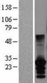 CT45A2 Protein - Western validation with an anti-DDK antibody * L: Control HEK293 lysate R: Over-expression lysate