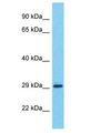 CT47A11 Antibody - CT47A11 antibody Western Blot of HeLa. Antibody dilution: 1 ug/ml.  This image was taken for the unconjugated form of this product. Other forms have not been tested.