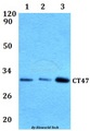 CT47A11 Antibody - Western blot of CT47 antibody at 1:500 dilution. Lane 1: HEK293T whole cell lysate.