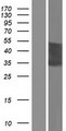 CT47A5 Protein - Western validation with an anti-DDK antibody * L: Control HEK293 lysate R: Over-expression lysate