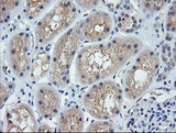 CTAG1B / NY-ESO-1 Antibody - IHC of paraffin-embedded Human Kidney tissue using anti-CTAG1B mouse monoclonal antibody.