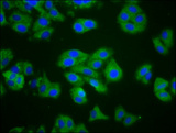 CTAGE1 / CTAGE Antibody - Immunofluorescence staining of HepG2 cells diluted at 1:200, counter-stained with DAPI. The cells were fixed in 4% formaldehyde, permeabilized using 0.2% Triton X-100 and blocked in 10% normal Goat Serum. The cells were then incubated with the antibody overnight at 4°C.The Secondary antibody was Alexa Fluor 488-congugated AffiniPure Goat Anti-Rabbit IgG (H+L).