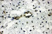 CTBP1 / CTBP Antibody - CTBP1 / CTBP antibody. IHC(P): Rat Brain Tissue.