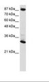CTCF Antibody - Transfected 293T Cell Lysate.  This image was taken for the unconjugated form of this product. Other forms have not been tested.
