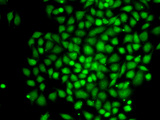 CTCFL / BORIS Antibody - Immunofluorescence analysis of MCF-7 cell using CTCFL antibody. Blue: DAPI for nuclear staining.
