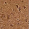 CTDP1 / FCP1 Antibody - Formalin-fixed and paraffin-embedded human brain tissue with CTDP1 Antibody , which was peroxidase-conjugated to the secondary antibody, followed by DAB staining. This data demonstrates the use of this antibody for immunohistochemistry; clinical relevance has not been evaluated.