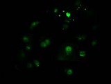 CTDSP1 / SCP1 Antibody - Anti-CTDSP1 mouse monoclonal antibody immunofluorescent staining of COS7 cells transiently transfected by pCMV6-ENTRY CTDSP1.