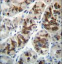 CTGF Antibody - CTGF Antibody immunohistochemistry of formalin-fixed and paraffin-embedded human stomach tissue followed by peroxidase-conjugated secondary antibody and DAB staining.