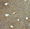CTH / Cystathionase Antibody - IHC analysis of CTH using anti-CTH antibody. CTH was detected in paraffin-embedded section of mouse liver tissue. Heat mediated antigen retrieval was performed in citrate buffer (pH6, epitope retrieval solution) for 20 mins. The tissue section was blocked with 10% goat serum. The tissue section was then incubated with 1µg/ml rabbit anti-CTH Antibody overnight at 4°C. Biotinylated goat anti-rabbit IgG was used as secondary antibody and incubated for 30 minutes at 37°C. The tissue section was developed using Strepavidin-Biotin-Complex (SABC) with DAB as the chromogen.