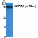 CTNNB1 / Beta Catenin Antibody - Western blot of Phospho-Catenin-beta (S552) antibody