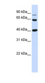 CTNNB1 / Beta Catenin Antibody - CTNNB1 / Beta Catenin antibody Western blot of Fetal Heart lysate. This image was taken for the unconjugated form of this product. Other forms have not been tested.