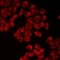 CTNS / Cystinosin Antibody