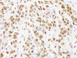 CTR9 Antibody - Detection of Mouse CTR9 by Immunohistochemistry. Sample: FFPE section of mouse teratoma. Antibody: Affinity purified rabbit anti-CTR9 used at a dilution of 1:250.