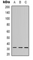 CTRP10 / C1QL2 Antibody - Western blot analysis of C1QL2 expression in A549 (A); MCF7 (B); HeLa (C) whole cell lysates.