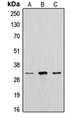 CTSA / Cathepsin A Antibody - Western blot analysis of Cathepsin A 32k expression in HepG2 (A); mouse kidney (B); rat liver (C) whole cell lysates.