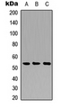 CTSA / Cathepsin A Antibody - Western blot analysis of Cathepsin A 20k expression in A549 (A); NS-1 (B); PC12 (C) whole cell lysates.