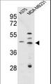 CTSD / Cathepsin D Antibody - Western blot of CTSD Antibody in A375, MDA-MB231 cell line lysates (35 ug/lane). CTSD (arrow) was detected using the purified antibody.