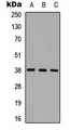 CTSL / Cathepsin L Antibody - Western blot analysis of Cathepsin L HC expression in HEK293T (A); NS-1 (B); PC12 (C) whole cell lysates.