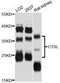 CTSL / Cathepsin L Antibody - Western blot analysis of extracts of various cell lines, using CTSL antibody at 1:3000 dilution. The secondary antibody used was an HRP Goat Anti-Rabbit IgG (H+L) at 1:10000 dilution. Lysates were loaded 25ug per lane and 3% nonfat dry milk in TBST was used for blocking. An ECL Kit was used for detection and the exposure time was 60s.