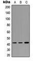 CTSW / Cathepsin W Antibody - Western blot analysis of Cathepsin W expression in HEK293T (A); NIH3T3 (B); PC12 (C) whole cell lysates.