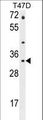 CTSZ / Cathepsin Z Antibody - CTSZ Antibody western blot of T47D cell line lysates (35 ug/lane). The CTSZ antibody detected the CTSZ protein (arrow).