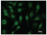 CUL3 / Cullin 3 Antibody - Immunofluorescent staining using CUL3 antibody. Immunostaining analysis in HeLa cells. HeLa cells were fixed with 4% paraformaldehyde and permeabilized with 0.01% Triton-X100 in PBS. The cells were immunostained with anti-CUL3 antibody.