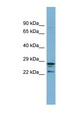 CUTC Antibody - CUTC antibody Western blot of 721_B cell lysate. This image was taken for the unconjugated form of this product. Other forms have not been tested.