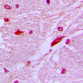 CUX1 / CASP Antibody - Immunohistochemical analysis of CUX1 staining in human brain formalin fixed paraffin embedded tissue section. The section was pre-treated using heat mediated antigen retrieval with sodium citrate buffer (pH 6.0). The section was then incubated with the antibody at room temperature and detected using an HRP conjugated compact polymer system. DAB was used as the chromogen. The section was then counterstained with hematoxylin and mounted with DPX.