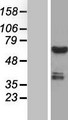CWF19L1 Protein - Western validation with an anti-DDK antibody * L: Control HEK293 lysate R: Over-expression lysate