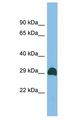 CWH43 Antibody - CWH43 antibody Western Blot of THP-1. Antibody dilution: 1 ug/ml.  This image was taken for the unconjugated form of this product. Other forms have not been tested.