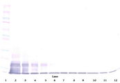 CX3CL1 / Fractalkine Antibody - Anti-Human Fractalkine (CX3CL1) Western Blot Unreduced