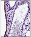 CX3CL1 / Fractalkine Antibody - Immunohistochemistry: CX3CL1 Antibody - Analysis of CX3CL in mouse lung.  This image was taken for the unconjugated form of this product. Other forms have not been tested.