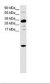 CXCL1 / GRO Alpha Antibody - Intestine Lysate.  This image was taken for the unconjugated form of this product. Other forms have not been tested.